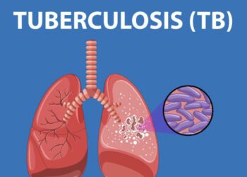 Senator Oluremi Tinubu Leads Charge Against TB on World TB Day 2025